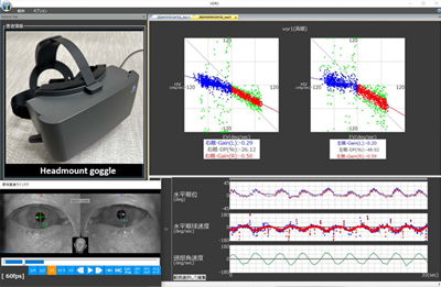 耳鼻咽喉科内藤クリニック 前庭眼反射（VOR）計測システム